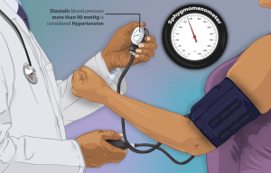 Hypertension Symptoms - Modafinil.org Hypertension Symptoms